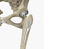 Short-Stay and Fast-Track Hip Replacement